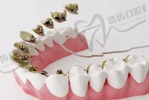 武汉爱尚大众口腔拔牙多少钱？医院优势显著