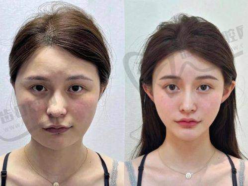 湖州98医院整形科价格表：透明价格明晰消费