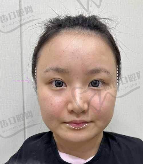 湖州俪莼医疗美容门诊部价格表
