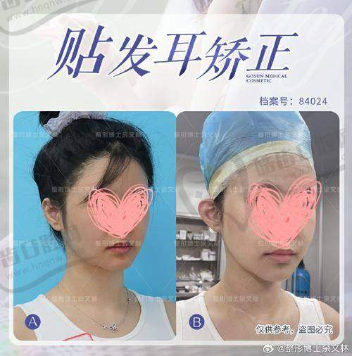 八、湖州同济医疗美容门诊部价格详情
