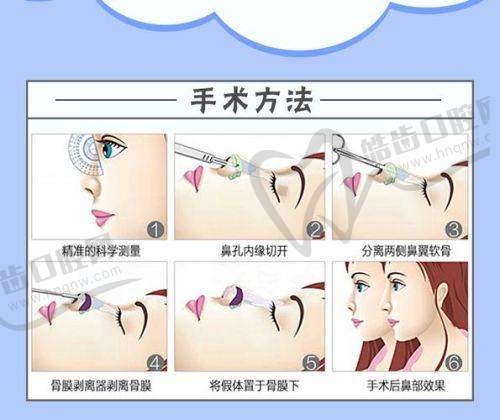 口碑评价与价格分析