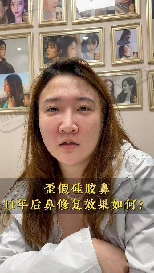 成功实例展示