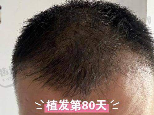 湖州98医院整形科项目特色：多样项目满足多元需求