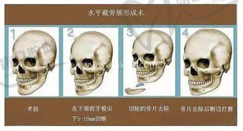 三、成都市第二人民医院医疗美容科医生介绍: