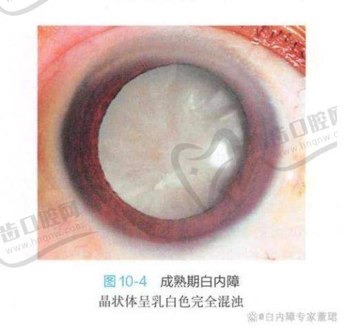李志华医生擅长项目