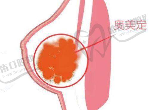 真实体验：一位求美者的术前术后对比感受