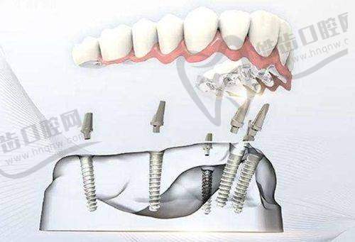 吉林市德立联合口腔医院电话快来瞅瞅,享多方式预约,体验中德联合口腔诊疗服务