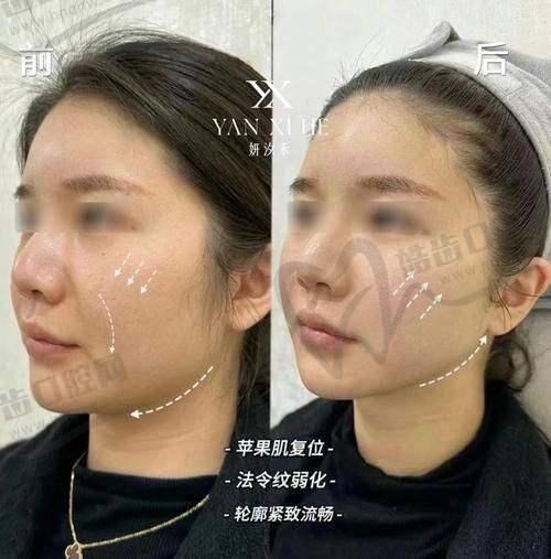 王世虎醫(yī)生所在醫(yī)院自體脂肪隆胸體驗