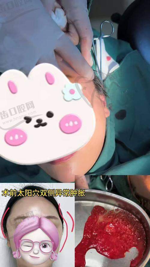 吴贞跃医生的手术成效怎么样？真实实例反馈来了