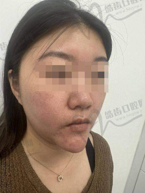 吴贞跃医生为啥口碑这么好？除了技术，细节服务也不能忽略