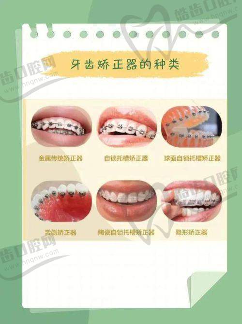 东莞东华医院口腔科正规吗？