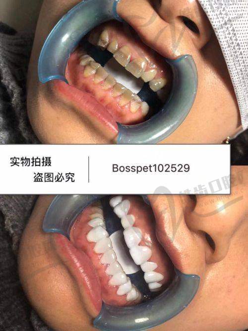 深圳海星口腔门诊部口碑如何