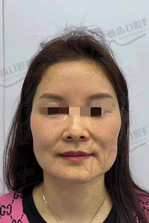 上海吴贞跃医生：馒化脸修复技术的老炮儿