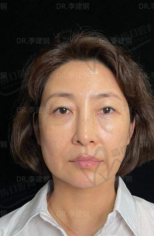 现在做价格能打折吗？哪些月份修复更划算？