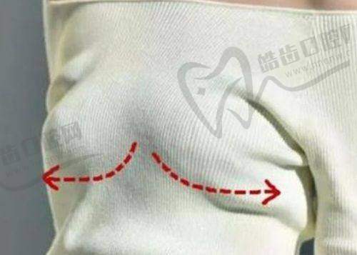 钦州华美整形医院胶原系列项目价格揭秘