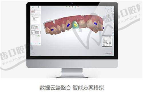 晏奇怎么预约?