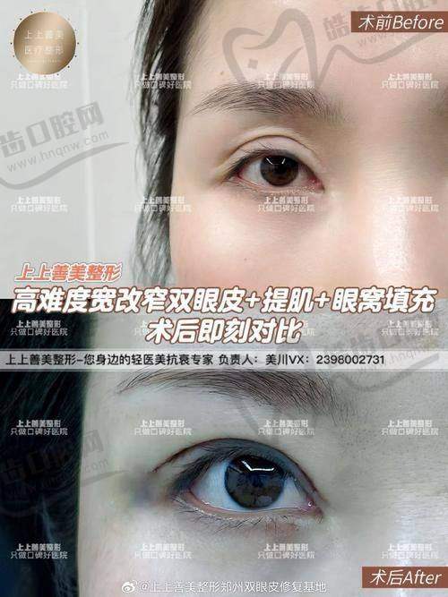 不必再试错，朱武根医生用专精和细节赢得信赖