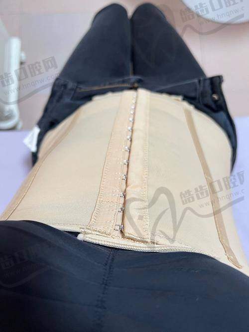一、什么是维蜜GR艺术体雕？一听就不是普通吸脂