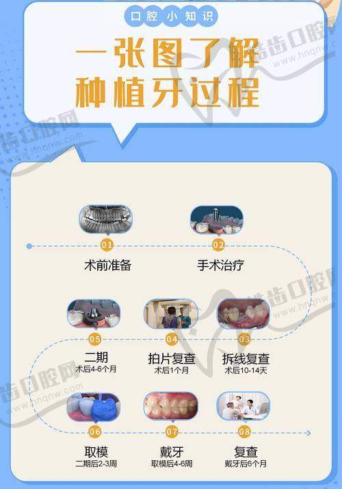 晏奇种植牙怎么样?