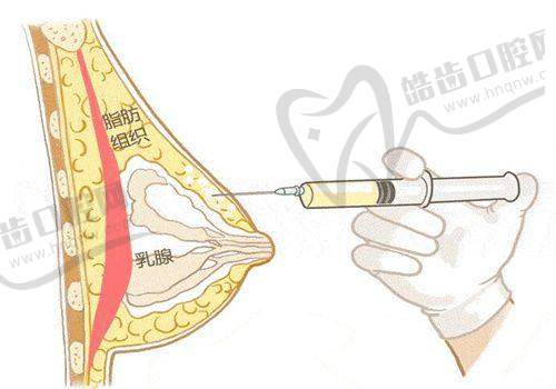 李微医生预约挂号