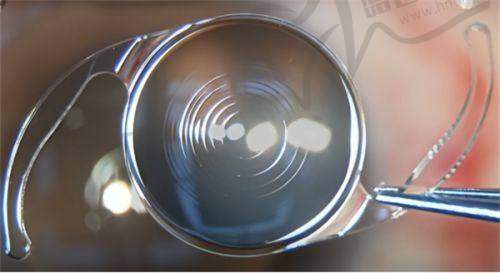 陈靖靖医生技术水平高