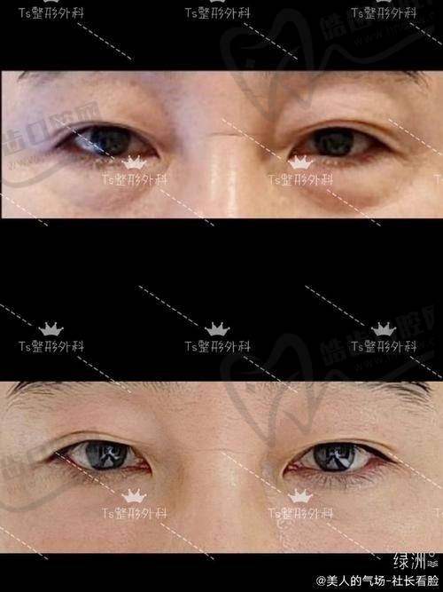 李鹏医生擅长项目