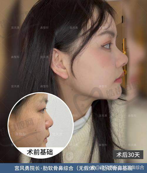 罗志敏医生擅长项目