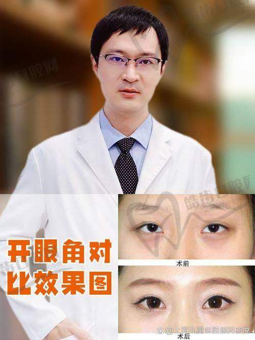 刘洋医生价格表