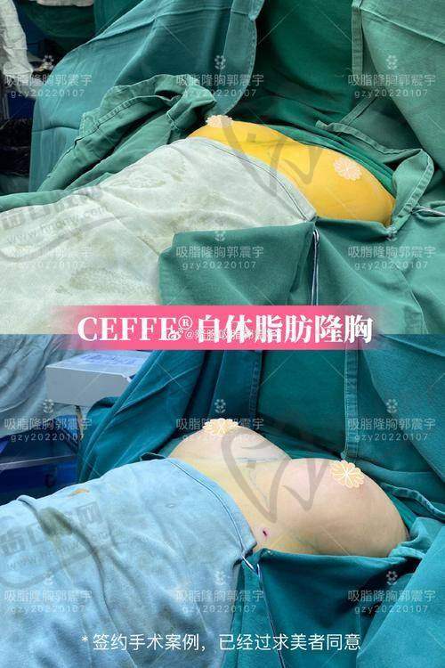 刘洋医生擅长项目
