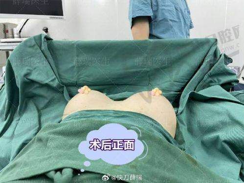 胡俊峰医生口碑评价及真人实例
