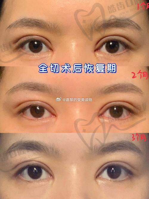 真实实例验证技术实力：从5次失败到逆袭重生