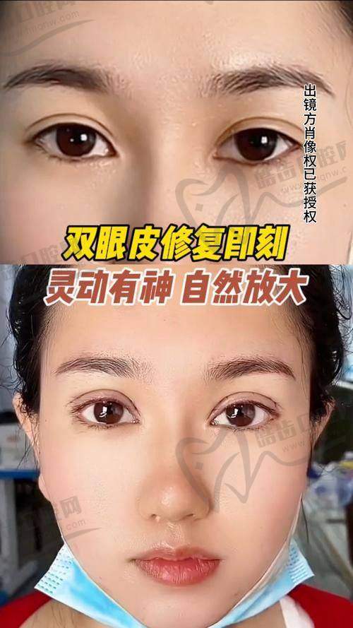 为何选择李燕医生？业内外患者一致力挺的“口碑女神”