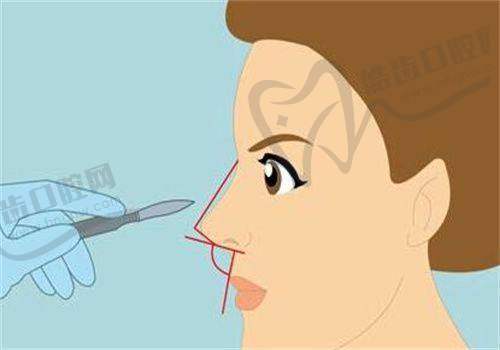 美波婷医疗美容医院:三重交联技术构建自然持久的丰胸支架