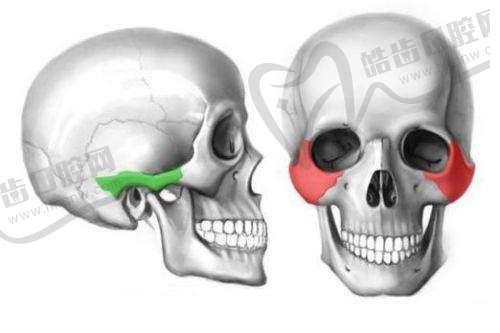 雅美医疗美容医院解析颧骨内推骨缝形成的必然性