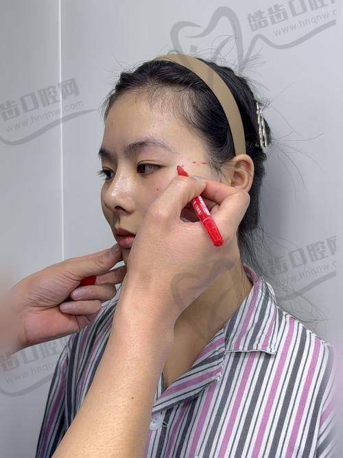 安心医美医院给出术后护理与应急处理建议