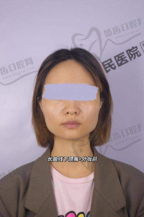 雅美医疗美容医院:面部软组织如何“填充”骨缝?