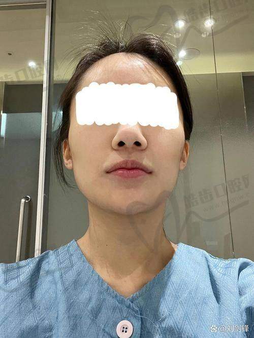 雅美医疗美容医院澄清关于骨缝的3个常见误区