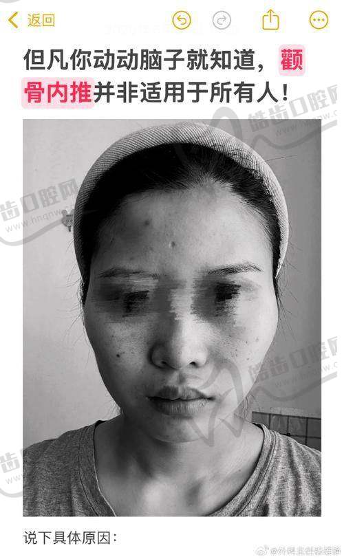 雅美医疗美容医院:术后护理如何助力骨缝正常修复?