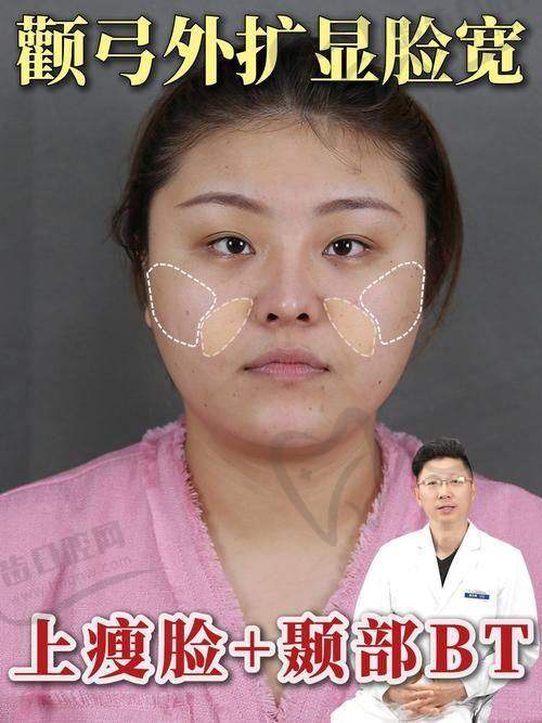 安心医美医院详解张嘴有响声的两大核心诱因