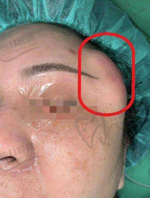 焕颜医美整形医院详解多数人生长因子代谢时间——几个月到一年是普遍规律