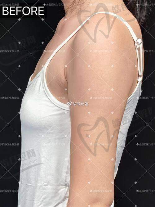 美波婷胶原蛋白丰胸的产品资质与生产标准