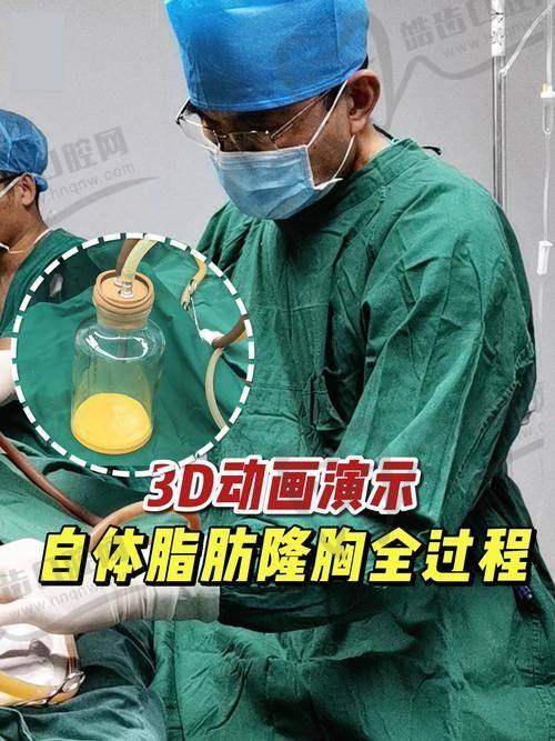 美波婷胶原蛋白丰胸的技术原理:不止“填充”,更能“再生”