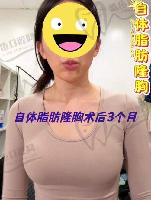 美波婷胶原蛋白丰胸的避坑建议:3招教你远离“美丽陷阱”