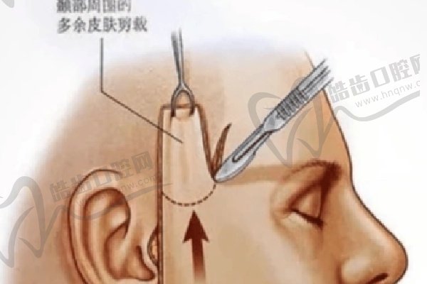 2025北京加减美v美减龄提升v6和v9区别在哪里？适合年龄不同揭晓口碑秘密